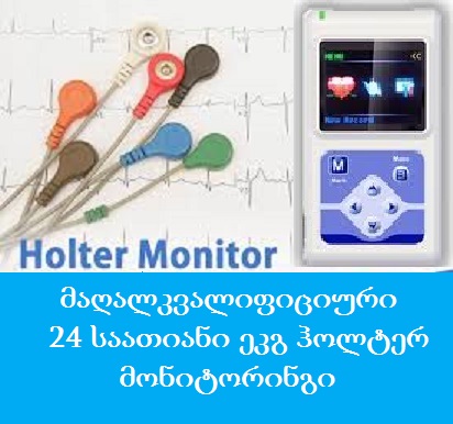 holter monitoringi